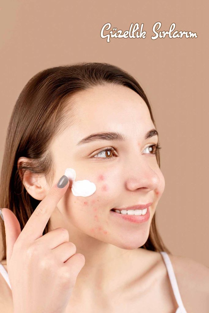 Sivex Losyon Hakkında Sıklıkla Sorulan Sorular