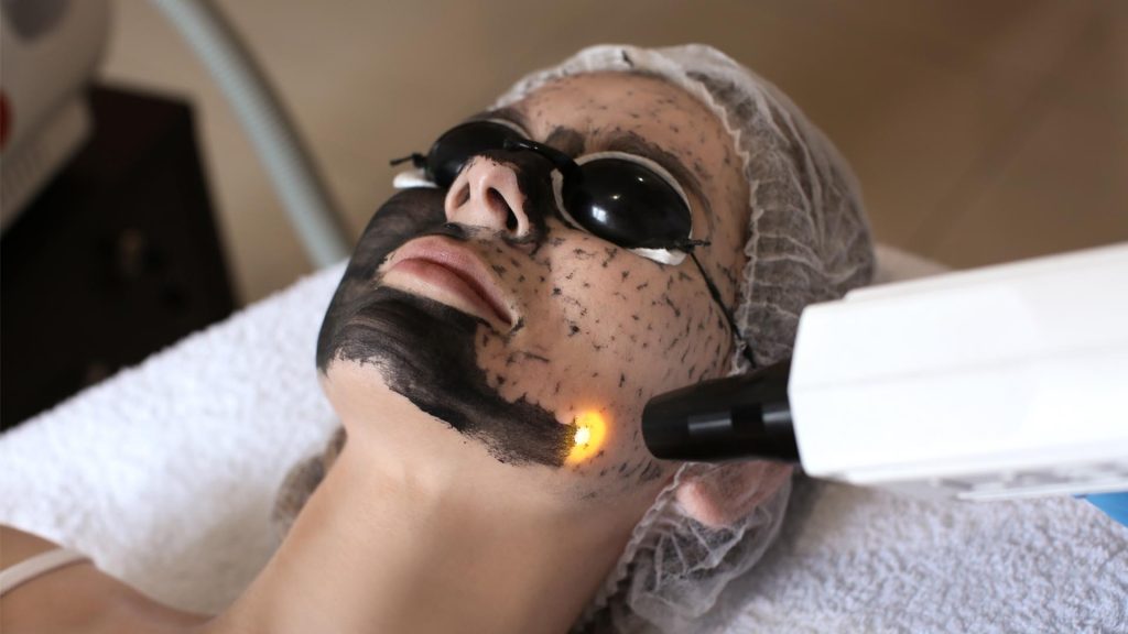 Karbon Peeling Nedir